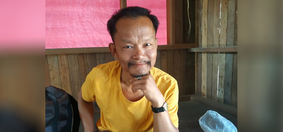 ရေနွေးပူ လောင်းခံခဲ့ရတဲ့ လူရွှင်တော် တော့ပ် / အားသစ် Facebook