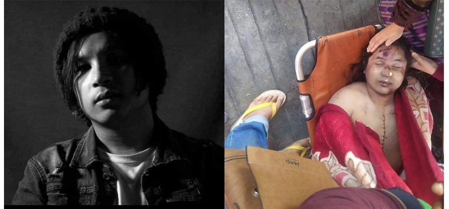 မီးကူငြှိမ်းပေးခဲ့သူ ကိုအောင်ပိုင်ထွေး၏ ရုပ်အလောင်း / CJ