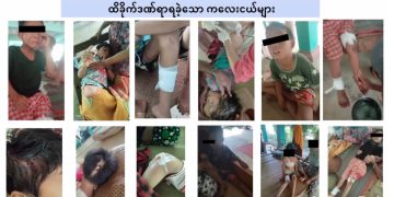 ဝန်းသိုတွင် ကျောင်းအနီး လက်နက်ကြီးပေါက်ကွဲမှုကြောင့် ဒဏ်ရာရသူ ကလေး ၇ ဦး အရေးပေါ် ကုသမှု လိုအပ်နေ