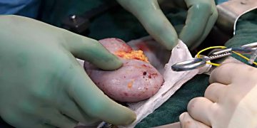 မြန်မာဆင်းရဲသားများ အိန္ဒိယသွားပြီး ကျောက်ကပ်များ ရောင်းစားနေ