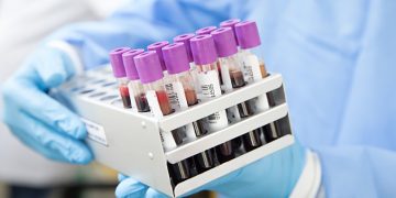 သြစတြေးလျမှ ပျောက်ဆုံးနေသော ဗိုင်းရပ်စ်နမူနာများအကြောင်း သိကောင်းစရာ